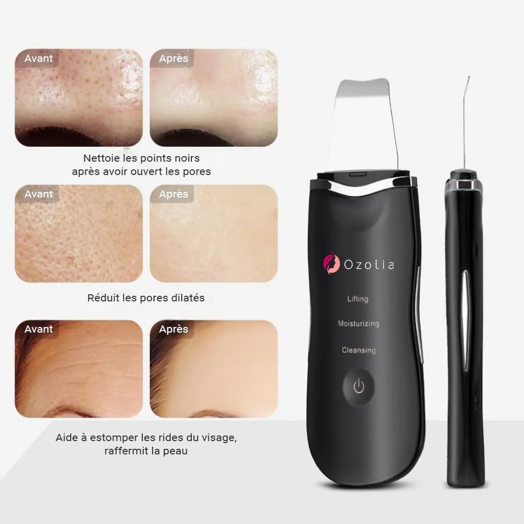 Sublima, appareil pour soins du visage qui permet Lifting, Nettoyage de la peau et hydratation par ultrasons - Nettoie les points noirs, réduit les pores dilatés, estompe les rides du visage, raffermit la peau - Boutique Ozolia